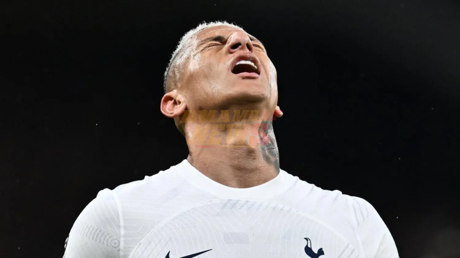 Richarlison estará hasta siete semanas de baja