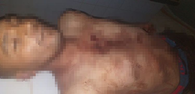 Matan a un hombre de dos estocadas durante trifulca en cancha de piky vóley en CDE