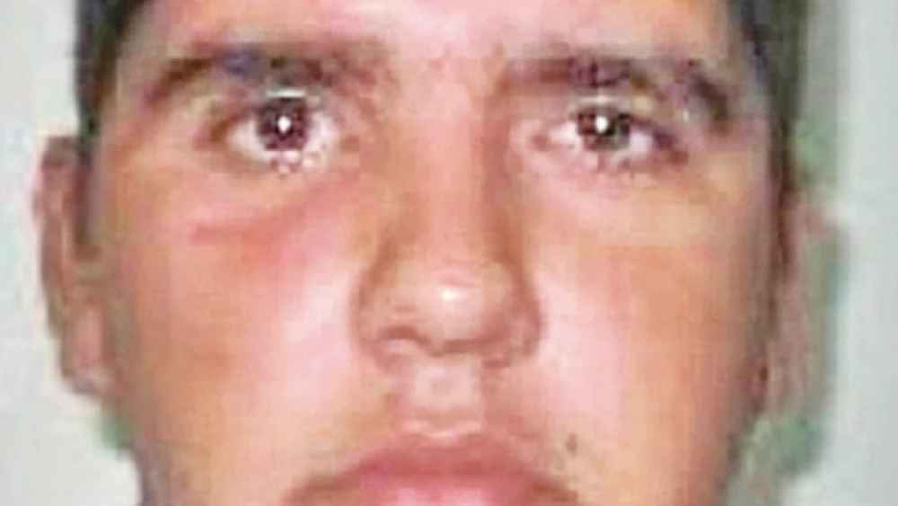 Amputan una pierna a suboficial baleado por marihuaneros en Capitán Bado