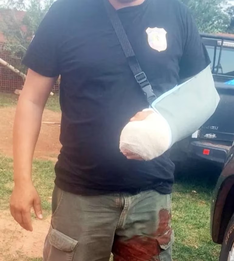 Ordenarían detención de Concejal Municipal por emboscada Policías