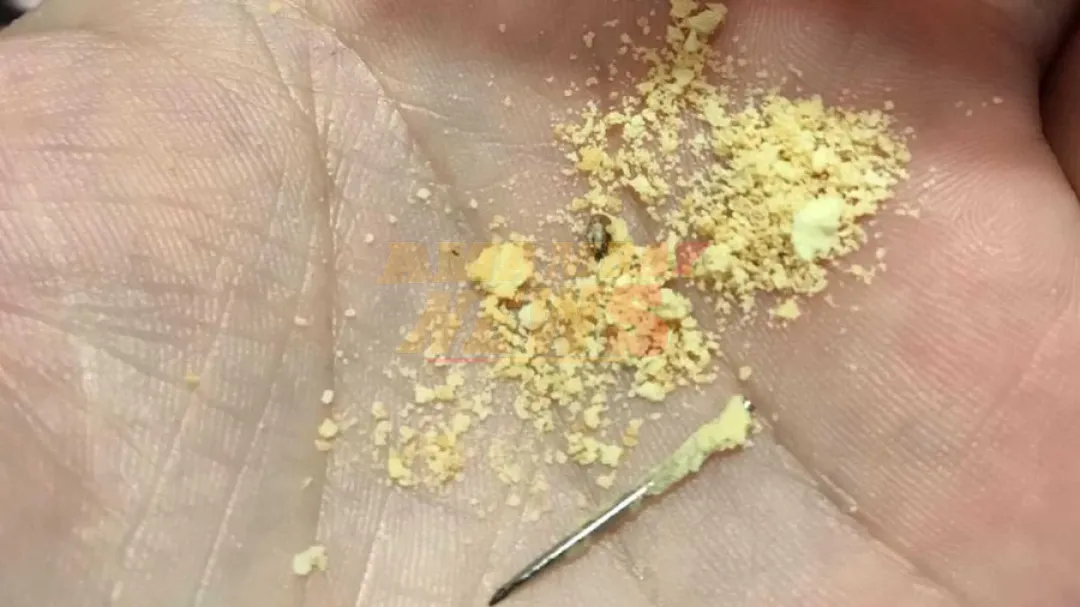Hambre Cero: Padre denuncia hallazgo de una aguja en chipita de la merienda escolar