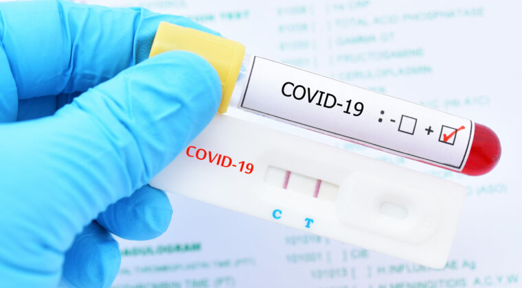 Semana cerró con 277 casos positivos y un fallecido por COVID