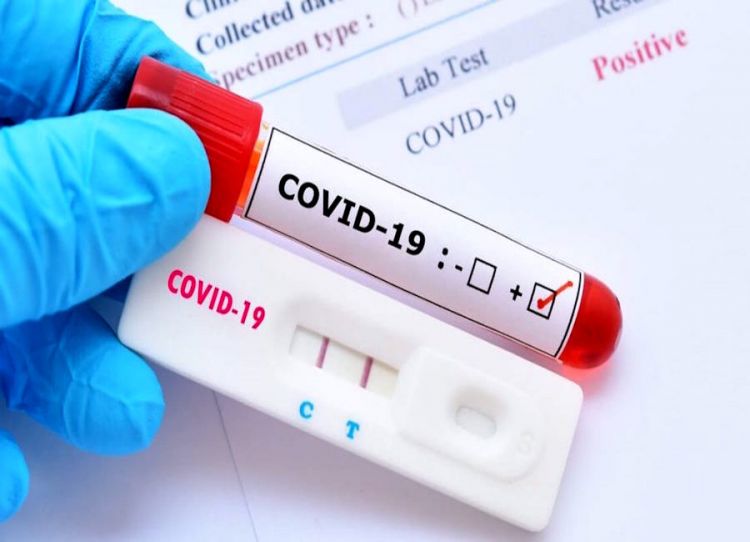 No se puede exigir test de Covid-19 para volver al trabajo, advierte Viceministerio