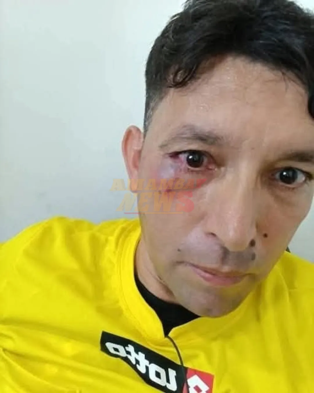 Arbitro recibe brutal agresión tras partido en Hernandarias