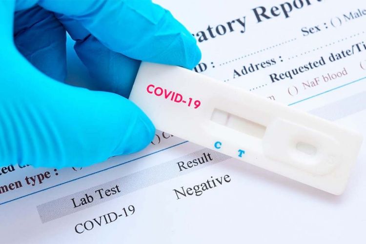 Salud reporta 958 casos de Covid-19