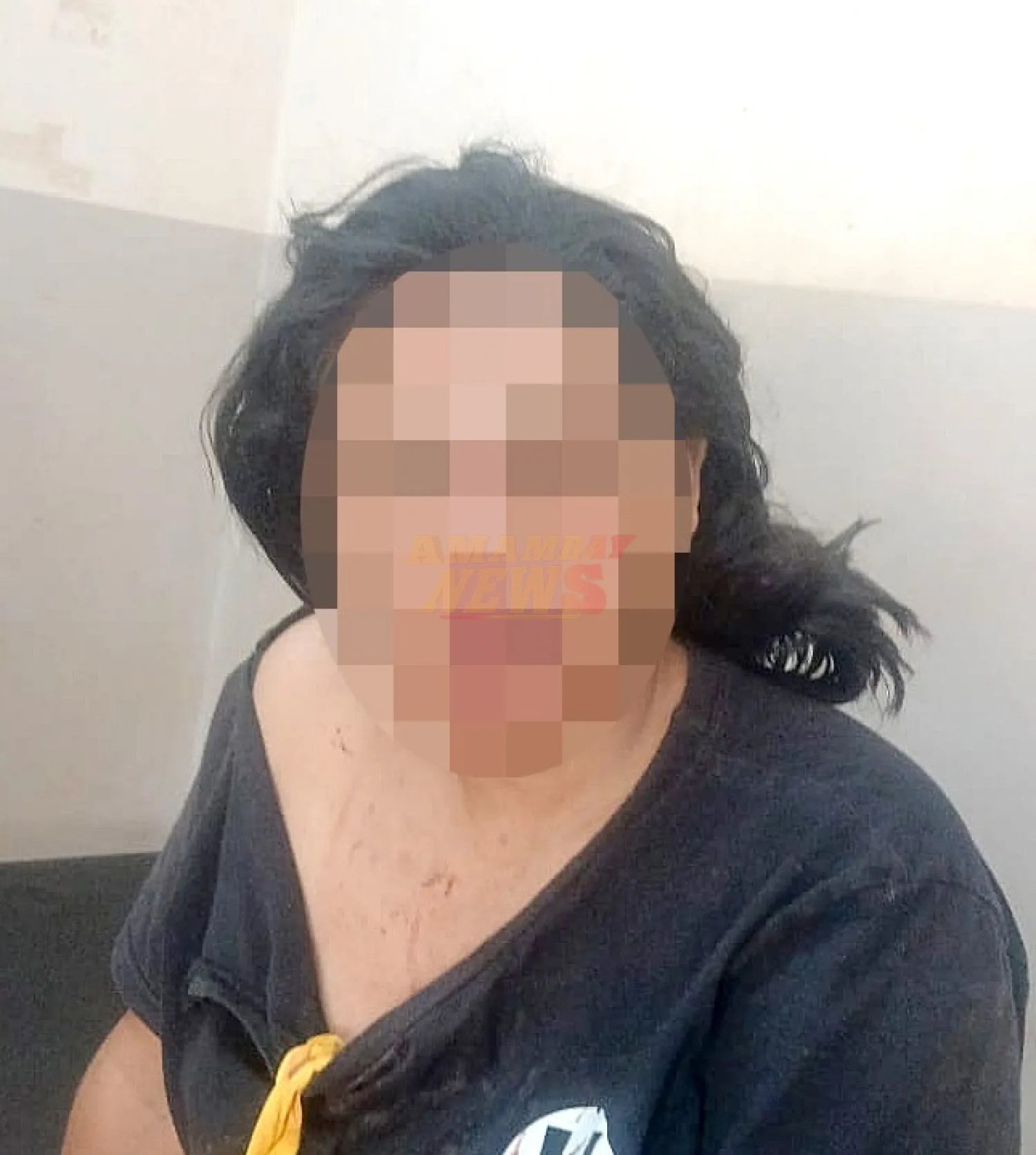 Mujer es agredida tras ser atropellada por su expareja