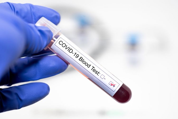 Salud informa sobre 14 muertes por coronavirus y 1.071 nuevos contagios