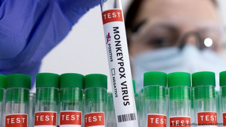 Detectan primer caso de viruela del mono en México