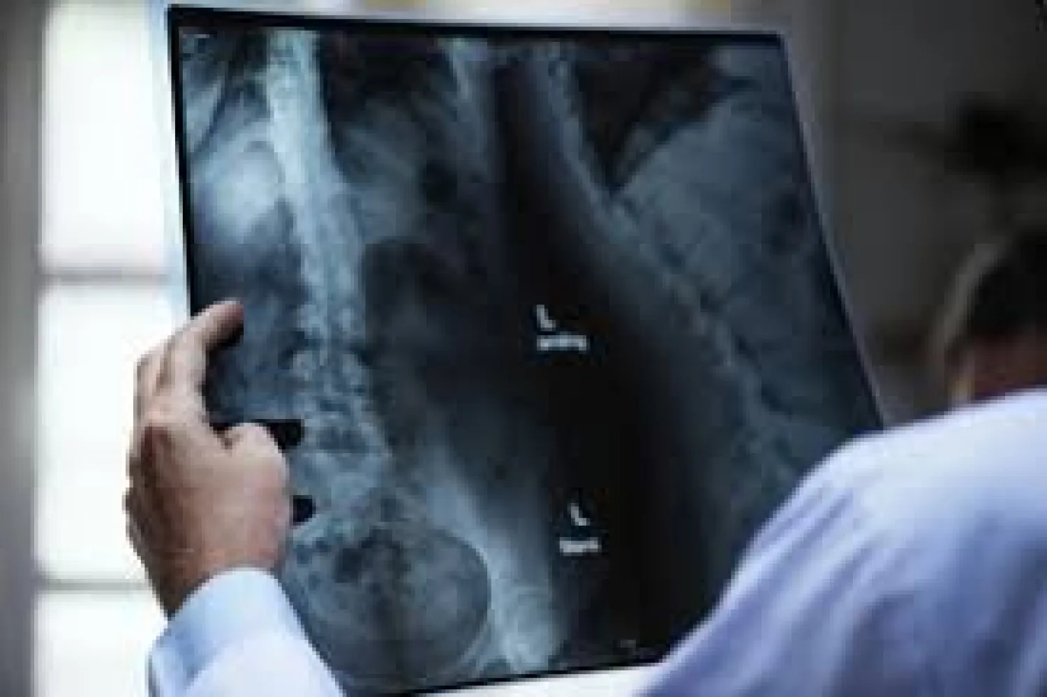 8 de noviembre: conmemoramos el día Mundial de la Radiología