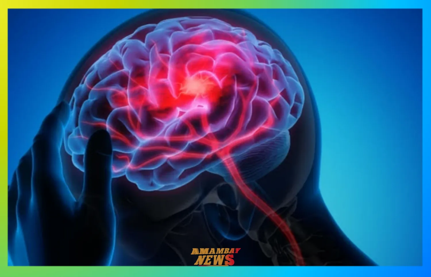 Día Nacional de la Epilepsia: Instan a reconocer los signos, actuar a tiempo y derribar mitos