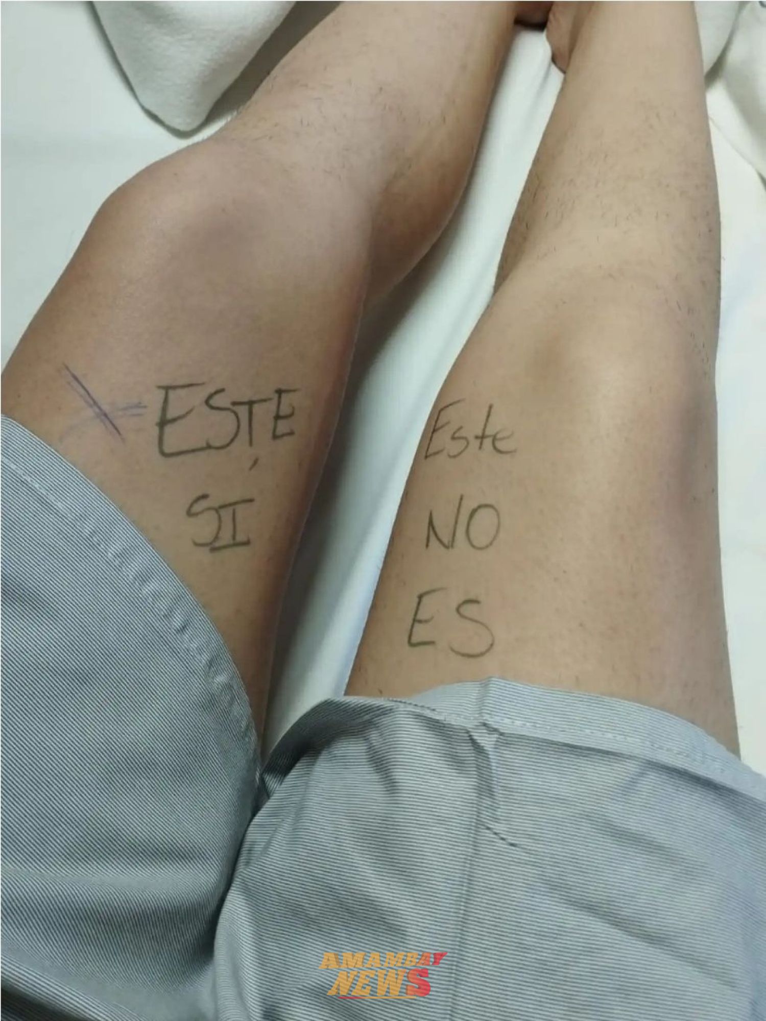 Pedrojuanina marca su rodilla antes de cirugía para evitar errores médicos