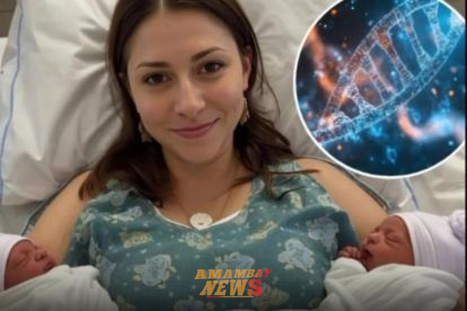 Caso médico inusual en Brasil: joven da a luz gemelos de padres biológicos distintos